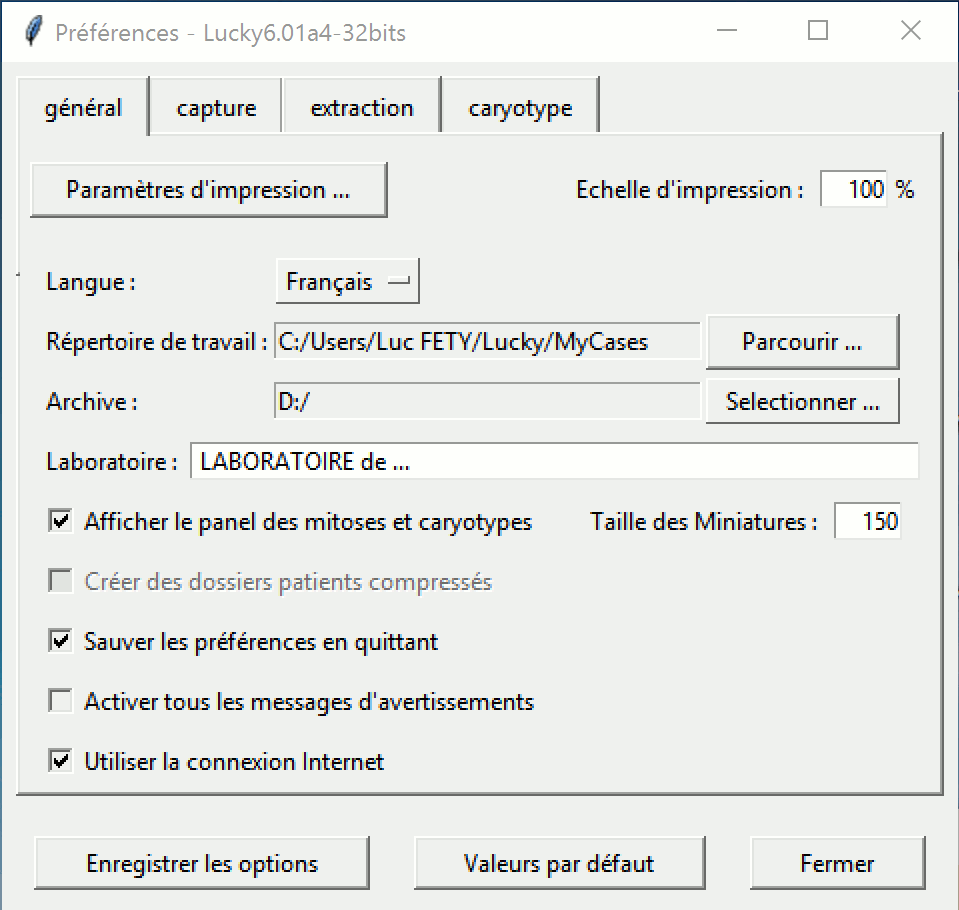 Parametres Impression